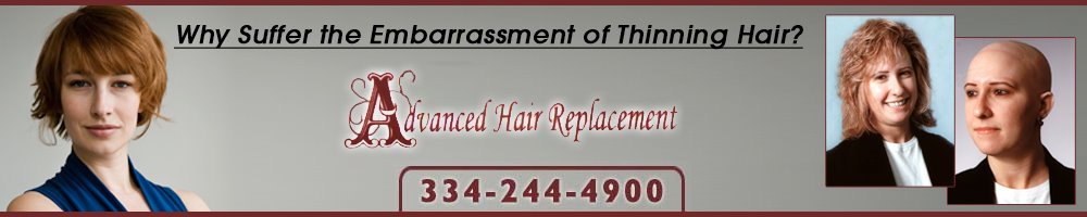 Advanced Hair Replacement
