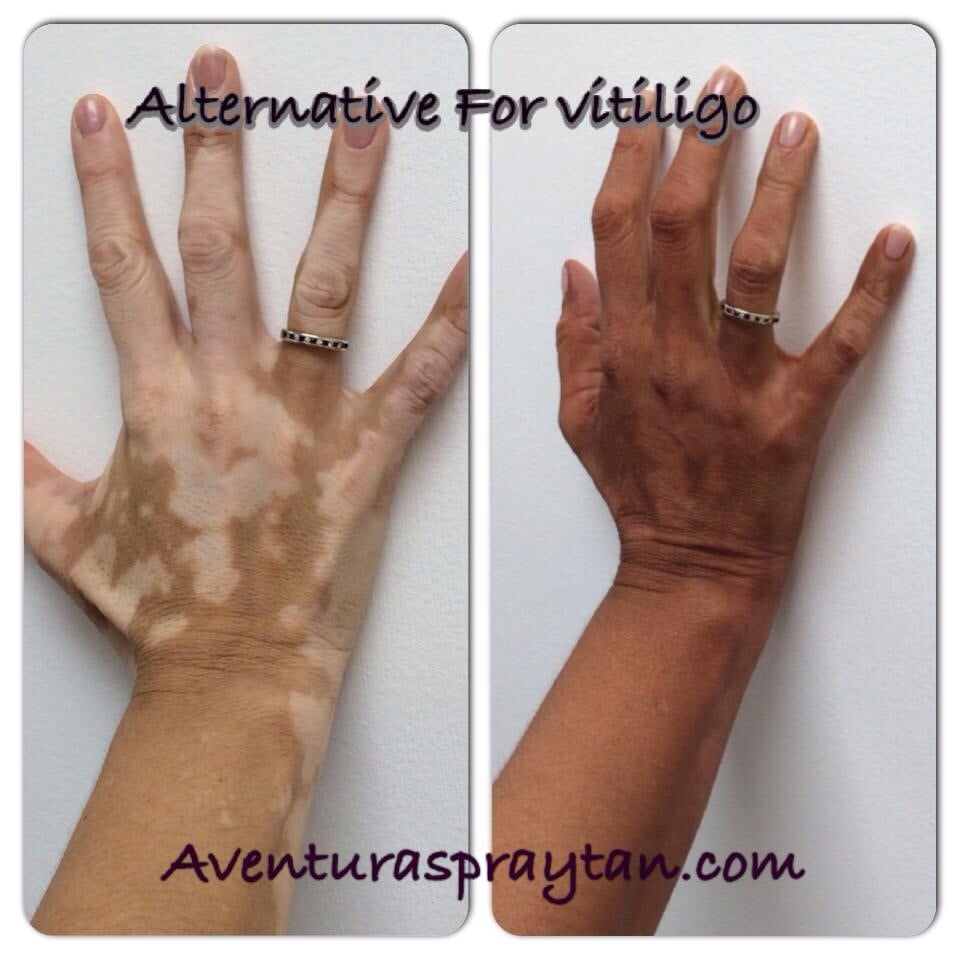 Aventura Spray Tan