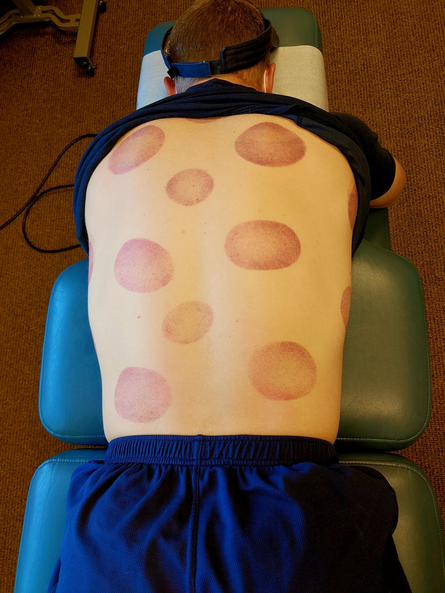 MyoFly Therapeutic Massage