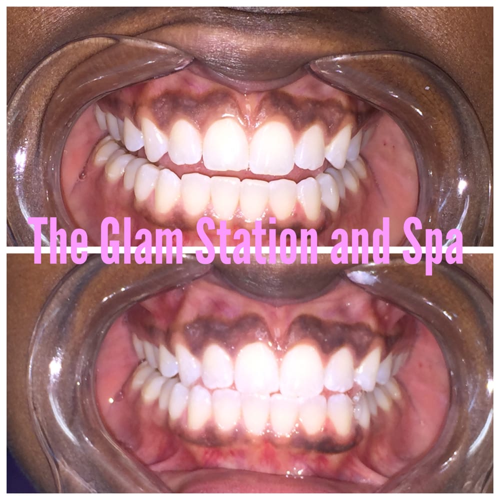 Photo credit: 